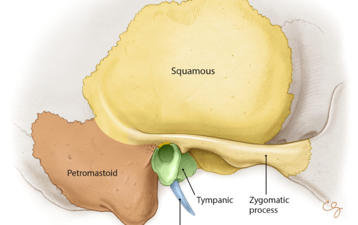 Overview Of Temporal Bone Oto Surgery Atlas