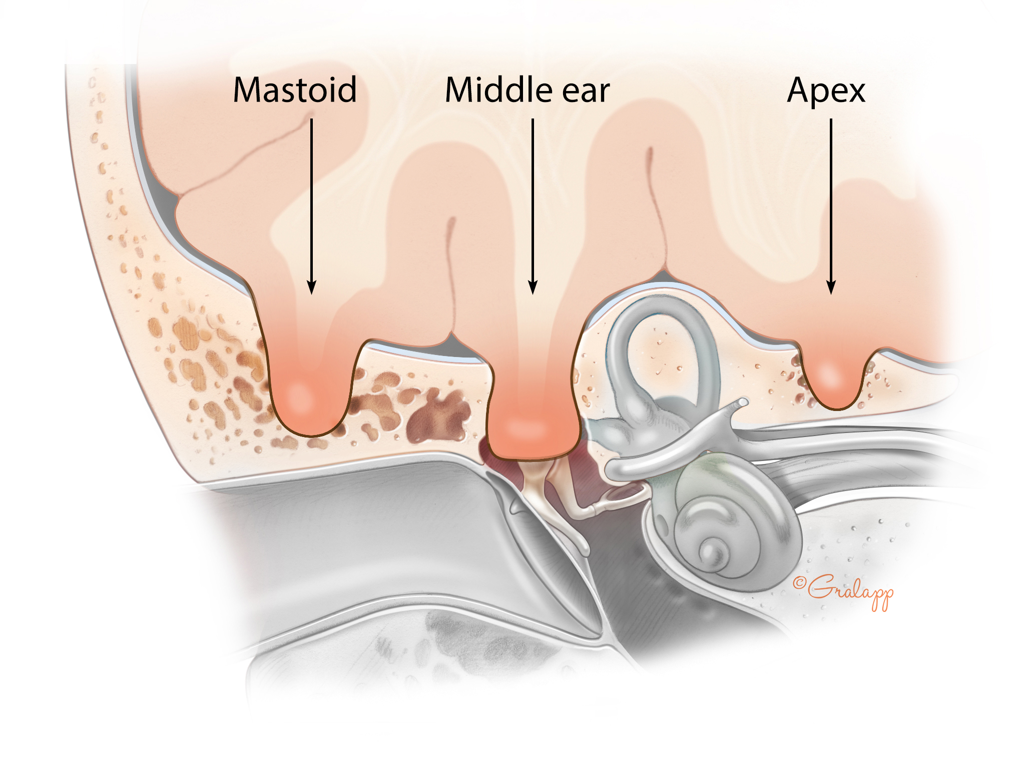 Middle Ear & Mastoid – Oto Surgery Atlas