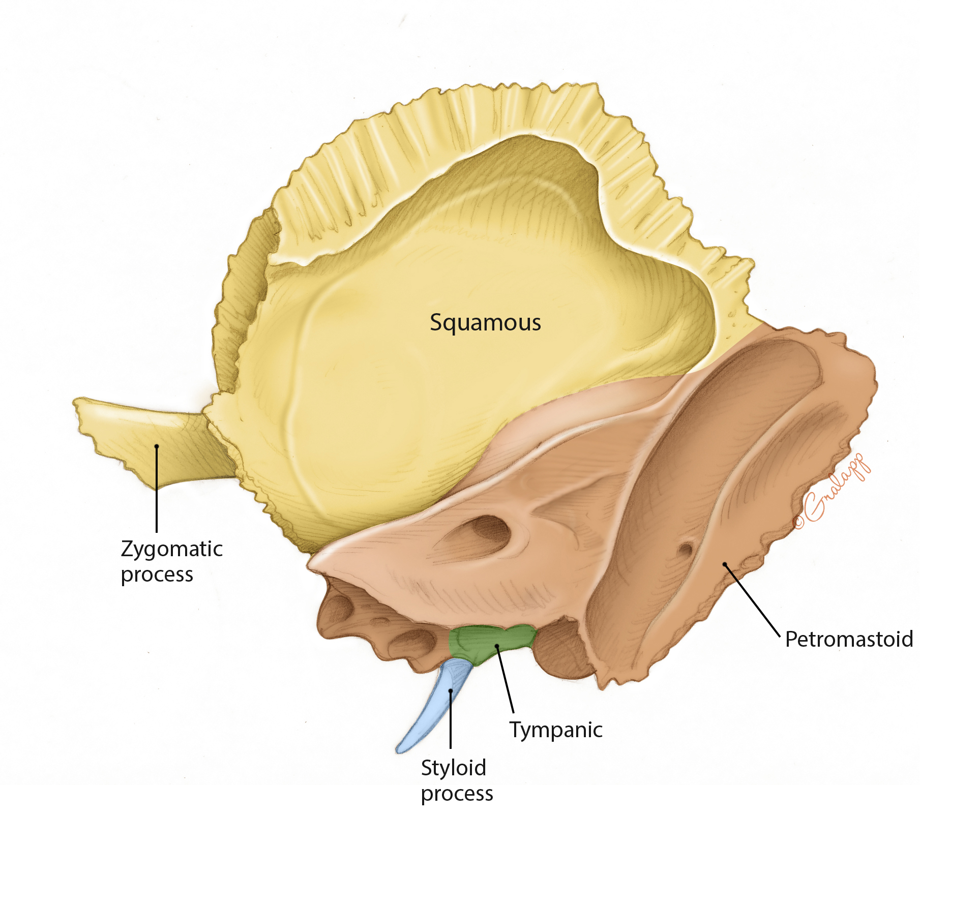 Temporal Bone Markings 7213