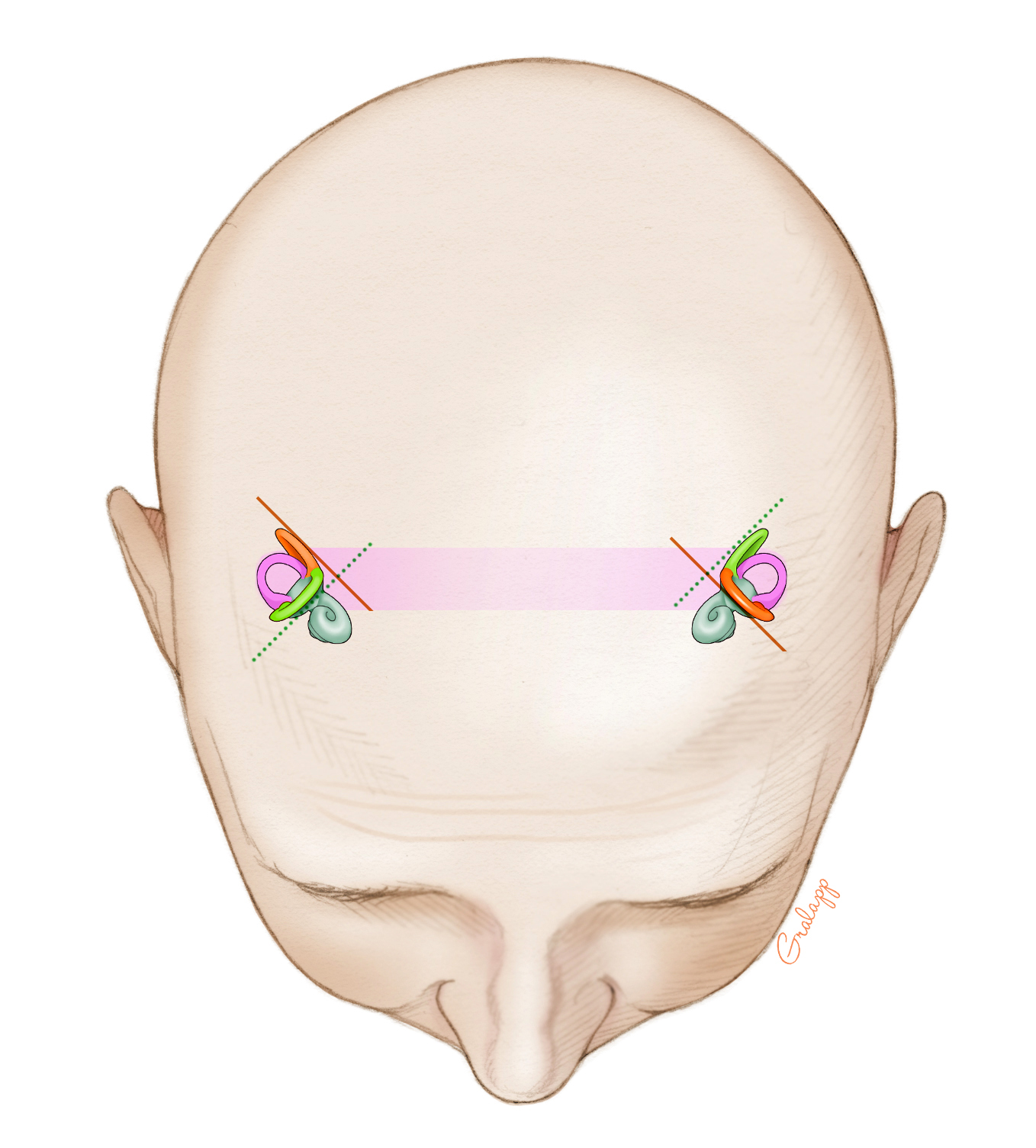 Vestibular System – Oto Surgery Atlas