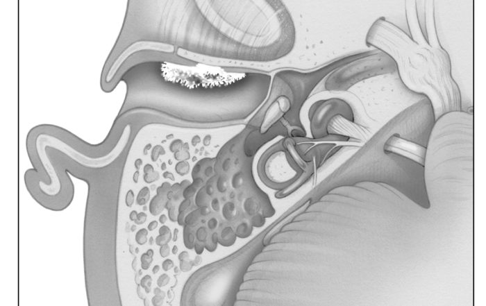 Ear Tumor Anatomy Oto Surgery Atlas