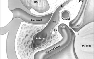 Anatomy of the jugular foramen: axial perspective.