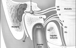 Anatomy of the jugular foramen: coronal perspective.