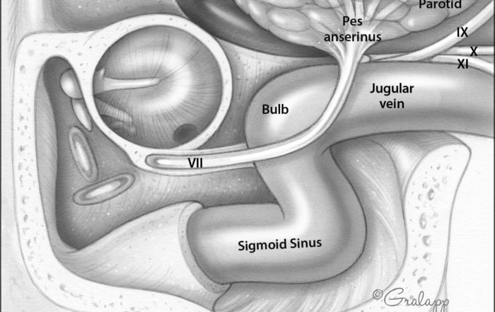 Ear Tumor Anatomy – Oto Surgery Atlas