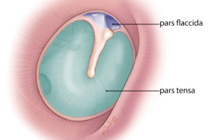 Pars tensa and pars flaccida of the tympanic membrane. The pars tensa has three layers: lateral stratified squamous epithelium, central fibrous layer, and medial low cuboidal mucosal epithelium. The pars flaccida is deficient in its fibrous layer.