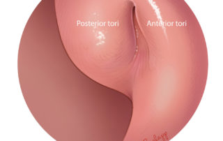 The opening of the Eustachian tube in the nasopharynx has anterior and posterior tori which are closed or can be touching at rest.