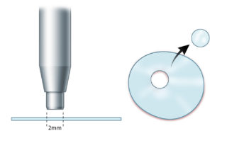 A disc of Gelfilm can help stabilize the prosthesis and discourage scar formation. After trimming to size, a dermatological punch is used to create a small aperture for the capitulum.