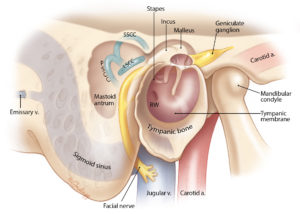 Anatomical relationships of the mastoid antrum and air cells: lateral view. LSCC, lateral semicircular canal; PSCC, posterior semicircular canal; SSCC, superior semicircular canal.
