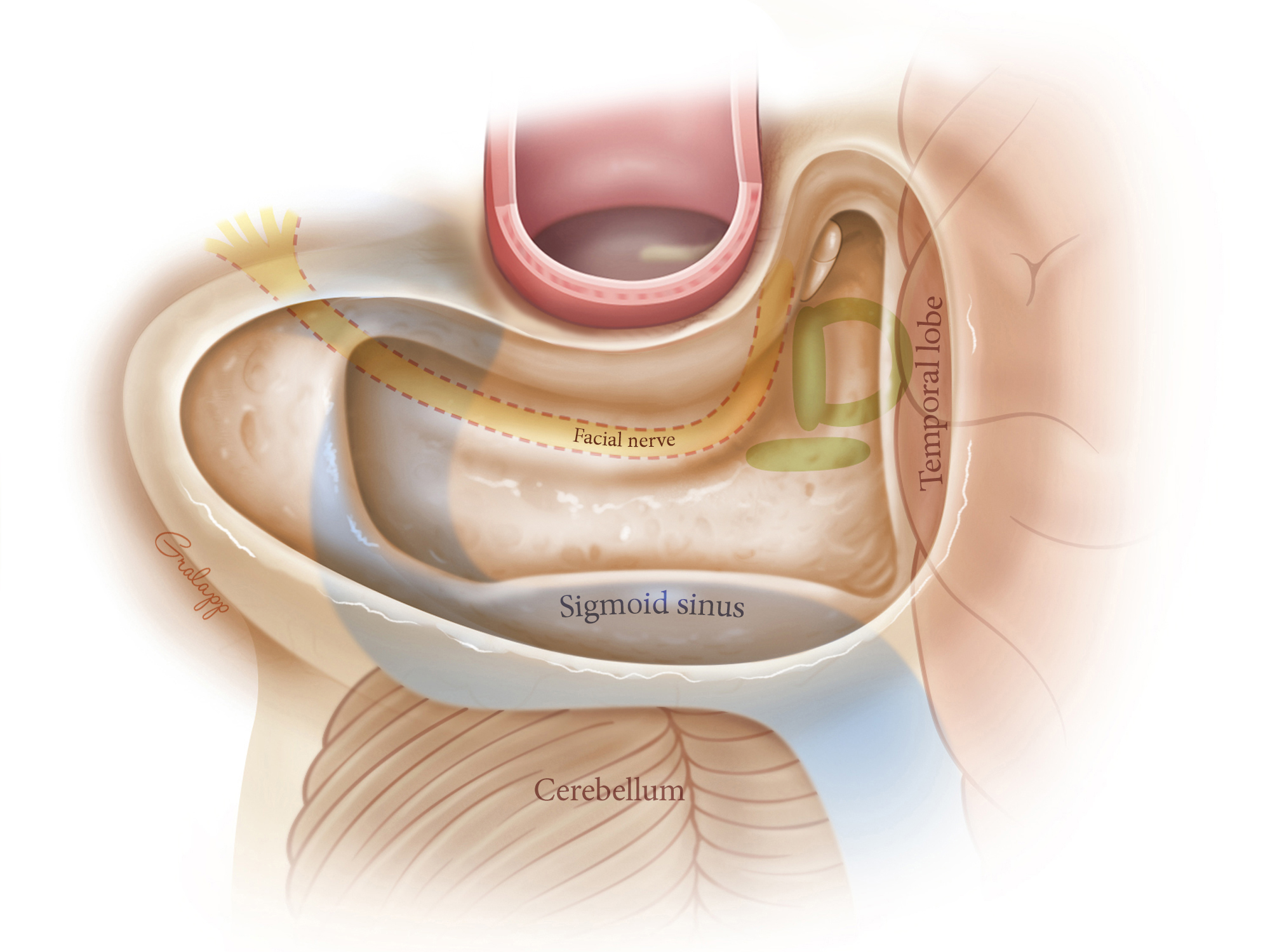 mastoidectomy-anatomy