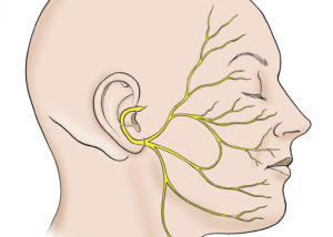 Overview of facial nerve anatomy from the brainstem exit to the terminal branches on the face.