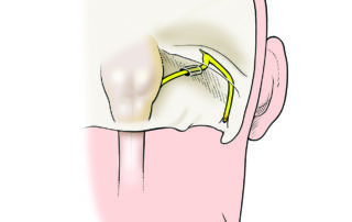 Note the three-dimensional complexity of the bends and turns en route from the brainstem exit to the stylomastoid foramen.